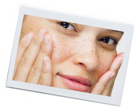 Quais as características mais comuns da pele sensível?